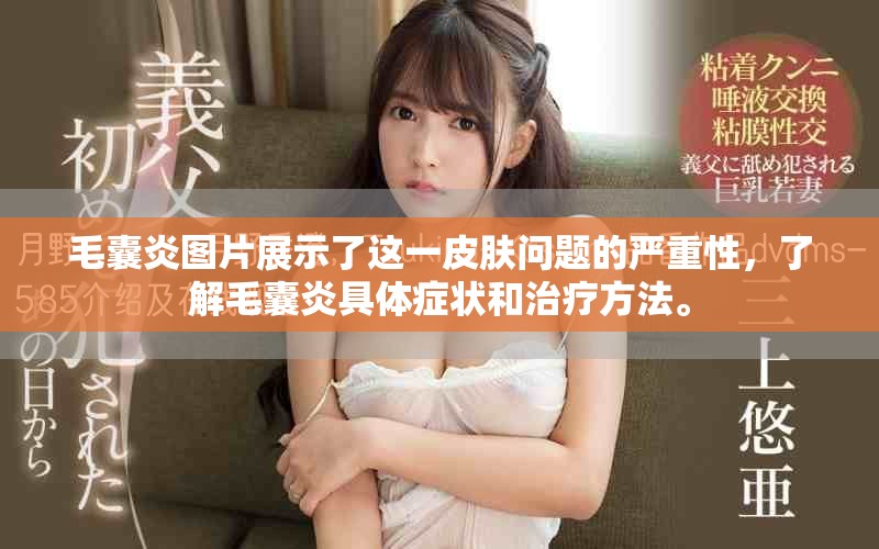 毛囊炎图片展示了这一皮肤问题的严重性，了解毛囊炎具体症状和治疗方法。