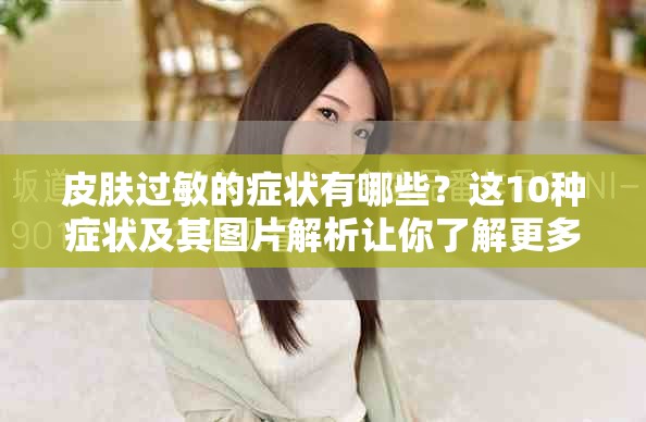 皮肤过敏的症状有哪些？这10种症状及其图片解析让你了解更多